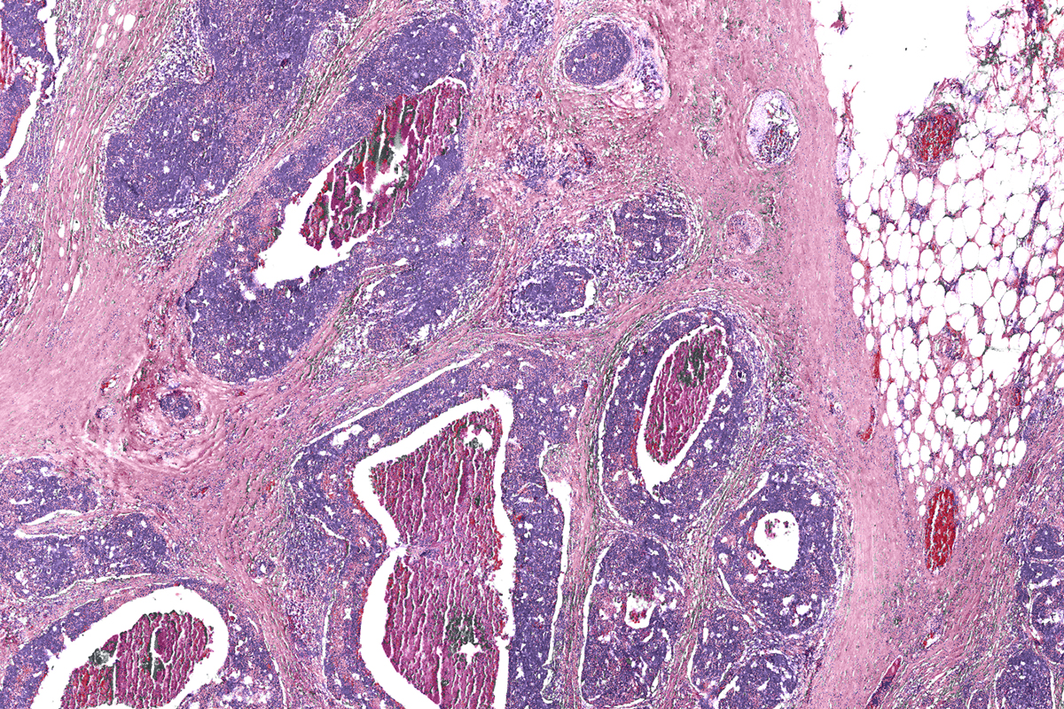 Image of a digital biopsy using an infrared-optical hybrid microscope.