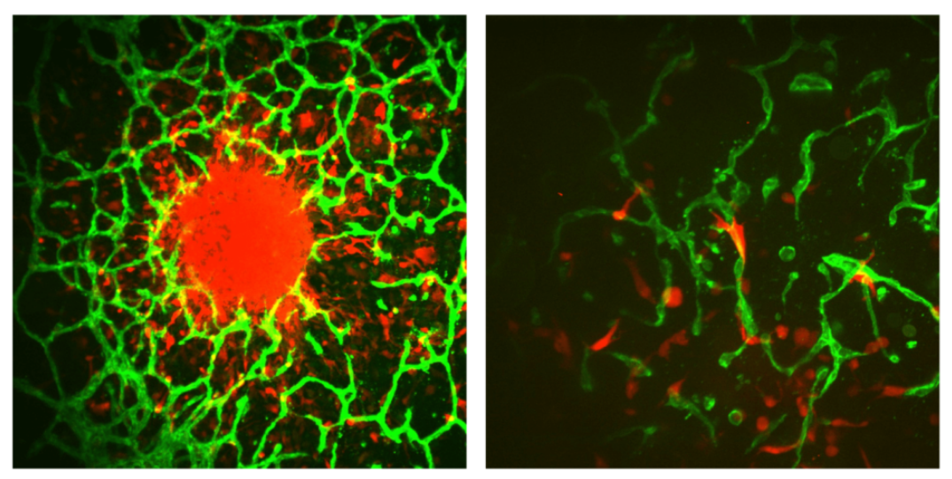 Left images shows individual cells invade away from a central tumor spheroid and into the surrounding vascularized microenvironment. Tumor cells are shown in red and vasculature is shown in green. And right image shows individual tumor cells (red) interact closely with surrounding vasculature (green). 