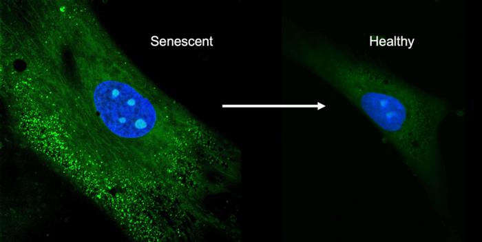 onfocal images of mesenchymal stem cells. The left shows the senescent cells producing unwanted biomolecules, the right shows the cells after treatment with the antioxidant crystals.