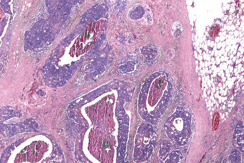 Image of a digital biopsy using an infrared-optical hybrid microscope.