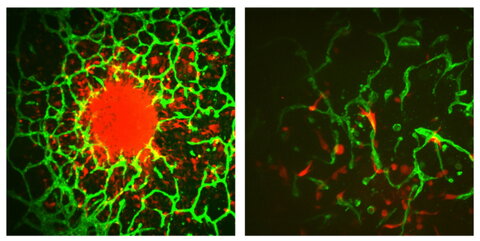 Left images shows individual cells invade away from a central tumor spheroid and into the surrounding vascularized microenvironment. Tumor cells are shown in red and vasculature is shown in green. And right image shows individual tumor cells (red) interact closely with surrounding vasculature (green). 