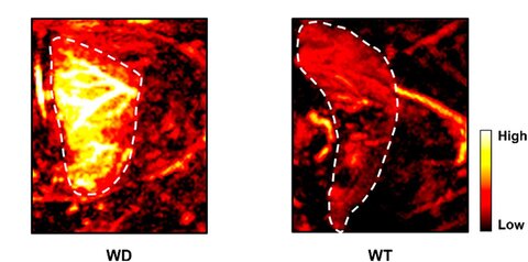 Two side-by-side predominantly red-colored images of mouse livers, comparing a mouse with Wilson's disease (left image showing a yellow-colored area) to a healthy mouse (right image with no yellow area). The bright spot (yellow) indicates higher concentrations of copper ions localized in that region.