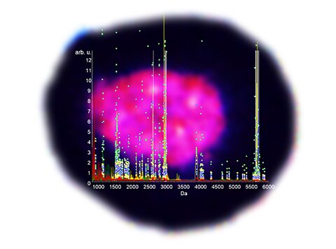 Pink and black image of Mass spectroscopic data acquired from multiple samples of the islets of Langerhans have been overlaid on isolated individual human islet of Langerhans that have been stained with dithizone.