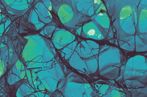 SEM image of the microstructure of a collagen sponge
