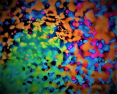 Processed, confocal fluorescence image showing human lung differentiation.