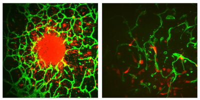 Left images shows individual cells invade away from a central tumor spheroid and into the surrounding vascularized microenvironment. Tumor cells are shown in red and vasculature is shown in green. And right image shows individual tumor cells (red) interact closely with surrounding vasculature (green).