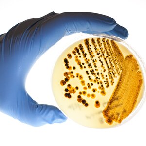 A blue-gloved hand holding a petri dish with bacteria.